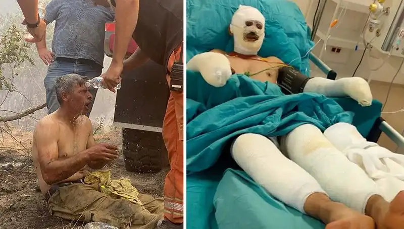 Orman İşçisinin "Yanıyorum" İğrenç Feryadı Güvenlik Önlemlerini Gündeme Getirdi