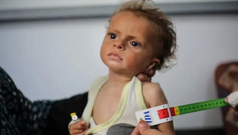 İngiltere’den Gazzeli Çocuklara Şefkat Eli: 300 Minik Can için Yeni Bir Umut