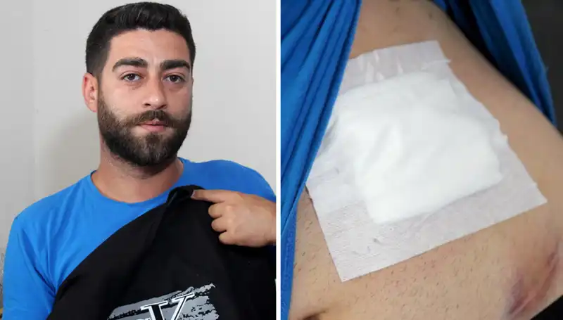 Karnındaki Ağrı, Korkunç Gerçeği Röntgende Ortaya Çıkardı