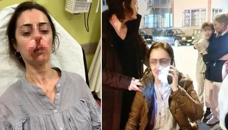 Eşinin Sevgilisi Sandığı Kapıyla Alevlendirdiği Kavga: Otomobil Kapısı Silah Sayıldı