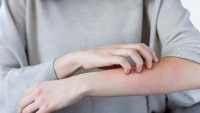 Cilt Kanserinin Gözden Kaçan İki Belirtisi: Dermatolog Uyarıyor!