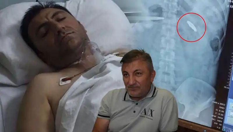 15 Temmuz’un İzleri: Vücudunda Kurşunla Yaşayan Kahramanın Hikayesi